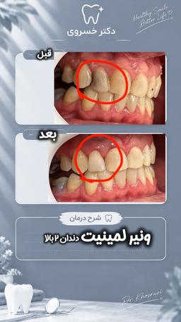 تصویر گالری کوثر خسروی 1