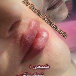 تصویر گالری پریسا معلم نیا 10