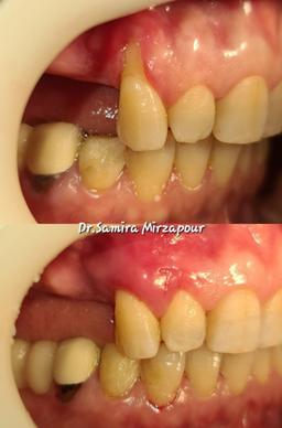 تصویر گالری سمیرا محمدمیرزاپور 7