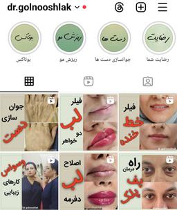 تصویر گالری گل نوش لک 1