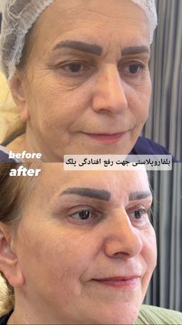 تصویر گالری زهرا ابراهیمی 3