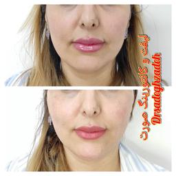 تصویر گالری حسن صادق زاده 7