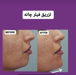 تصویر گالری مریم مدیرروستا 14