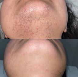 تصویر گالری ملیکا محمدزاده 19