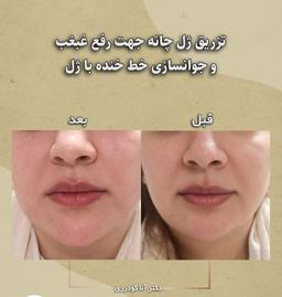 تصویر گالری آنا گودرزی 7