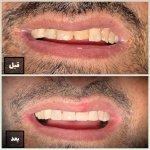 تصویر گالری سمانه فلاح 6