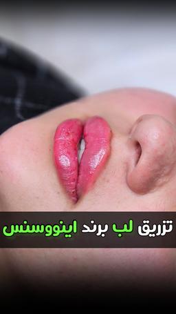 تصویر گالری محمدرضا رضایی کمال آباد 5