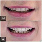 تصویر گالری سمانه فلاح 8