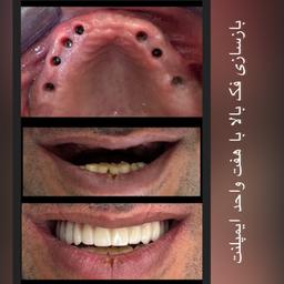 تصویر گالری عبدالکریم عزیزی 16