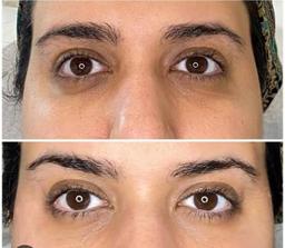 تصویر گالری شقایق نیک پور 2