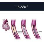 تصویر گالری آزاده داودیان دهکردی 4