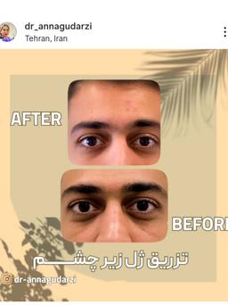 تصویر گالری آنا گودرزی 9