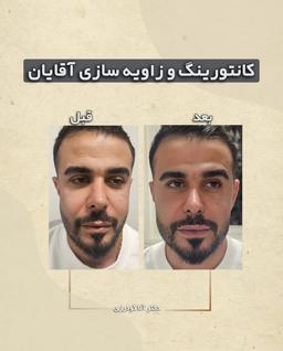 تصویر گالری آنا گودرزی 4