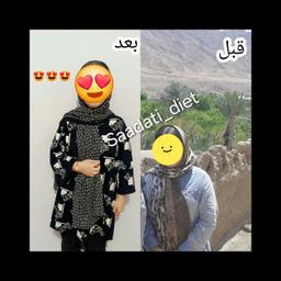 تصویر گالری سمیرا سعادتی 9