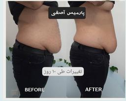 تصویر گالری پارمیس آصفی 3