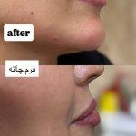 تصویر گالری مرضیه لطفی 1