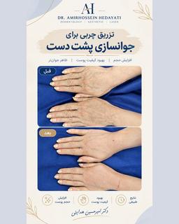 تصویر گالری امیرحسین هدایتی 3