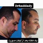 تصویر گالری شهریار حدادی ابیانه 3