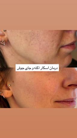 تصویر گالری زهرا حسن پور 8