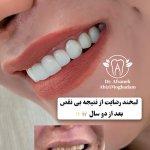 تصویر گالری افسانه آبیزی مقدم 9