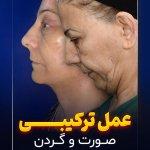 تصویر گالری شهریار حدادی ابیانه 2