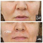 تصویر گالری امیرحسین هدایتی 2