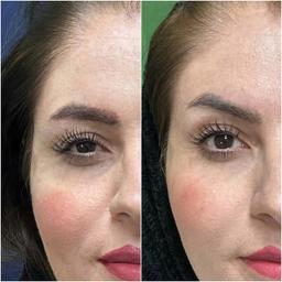 تصویر گالری محمدرضا رضایی کمال آباد 4