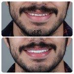 تصویر گالری مهسا دلشاد 2
