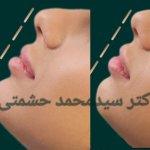 تصویر گالری سیدمحمد حشمتی 1