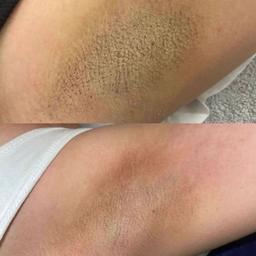 تصویر گالری ملیکا محمدزاده 11