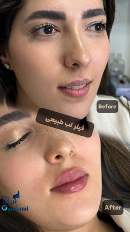 تصویر گالری میلاد گندمی محمدآبادی 8