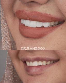 تصویر گالری طناز محزون 1