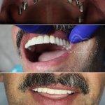 تصویر گالری محمدرضا چالاک 7