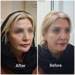 تصویر گالری آیدین غفاری 8