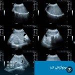 تصویر گالری نسرین امینی 22