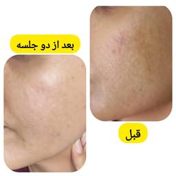 تصویر گالری فاطمه برومند 3