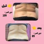 تصویر گالری نسترن رفیعی پور 7