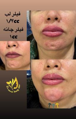 تصویر گالری عمران زوار 4