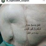 تصویر گالری محمدرضا تقی زاده 11