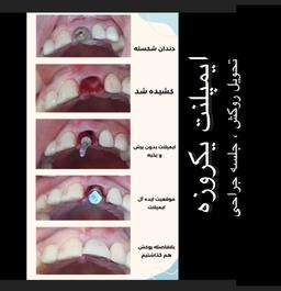 تصویر گالری عبدالکریم عزیزی 14