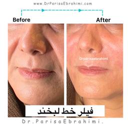 تصویر گالری پریسا ابراهیمی 5