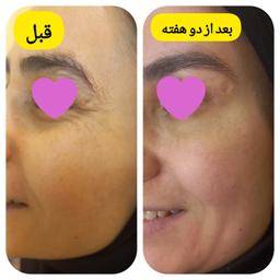 تصویر گالری فاطمه برومند 2