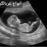 تصویر گالری نسرین امینی 21