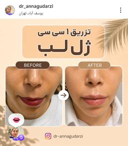 تصویر گالری آنا گودرزی 13