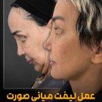 تصویر گالری شهریار حدادی ابیانه 4