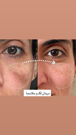 تصویر گالری زهرا حسن پور 7
