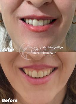 تصویر گالری زهرا حسن پور 4