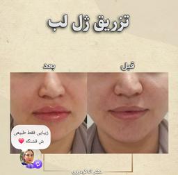 تصویر گالری آنا گودرزی 6