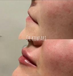 تصویر گالری مهسا کوثری 13