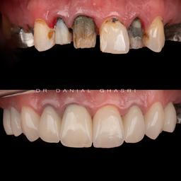 تصویر گالری دانیال قصری 3